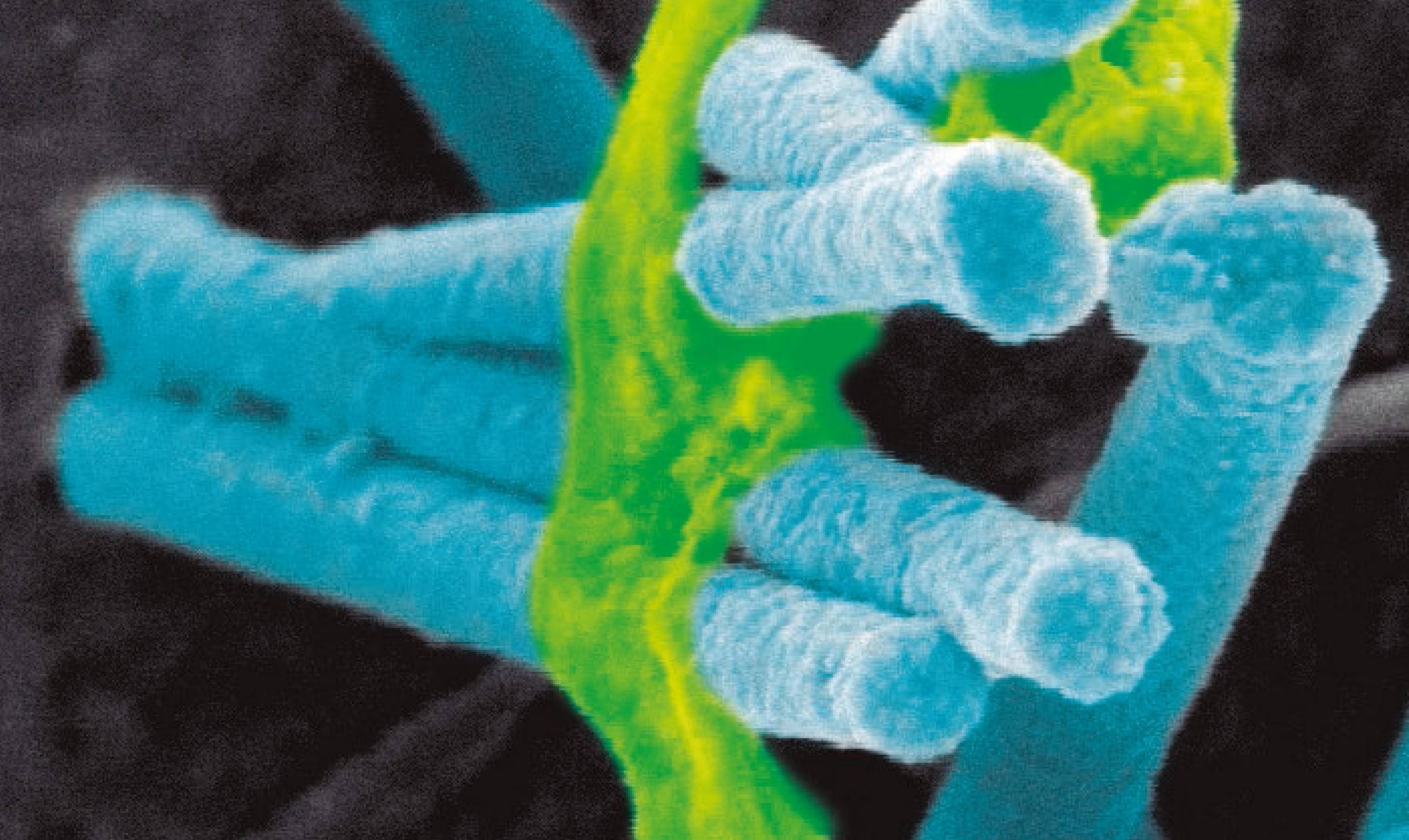 Axons wrapping metallic nanowires in a nanostructured electrode (in collaboration with M. C. Serrano at ICMM-CSIC, Spain). FOTCIENCIA photo contest 2019.